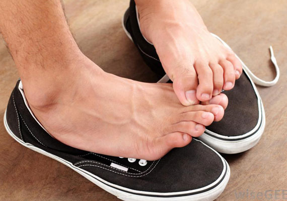 脚真菌感染会导致脚趾灰指甲症状